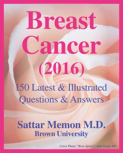 Book Cover Breast Cancer (2016): 150 Latest & Illustrated Questions & Answers