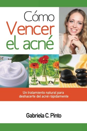 Book Cover Cómo Vencer el Acné: Un tratamiento natural para deshacerte del acné rápidamente (Spanish Edition)