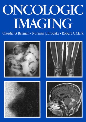 Book Cover Oncologic Imaging: A Clinical Perspective