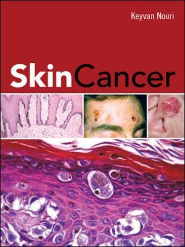 Book Cover Skin Cancer