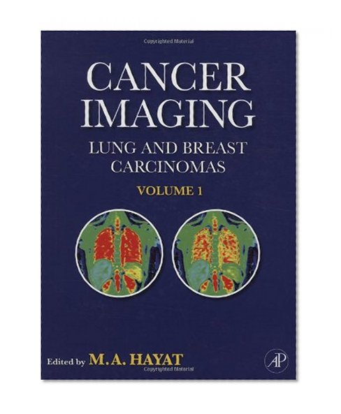 Book Cover Cancer Imaging: Lung and Breast Carcinomas