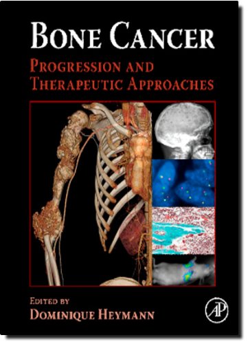 Book Cover Bone Cancer: Progression and Therapeutic Approaches