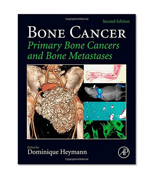 Book Cover Bone Cancer, Second Edition: Primary Bone Cancers and Bone Metastases