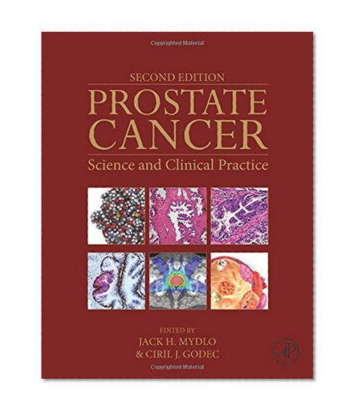 Book Cover Prostate Cancer, Second Edition: Science and Clinical Practice