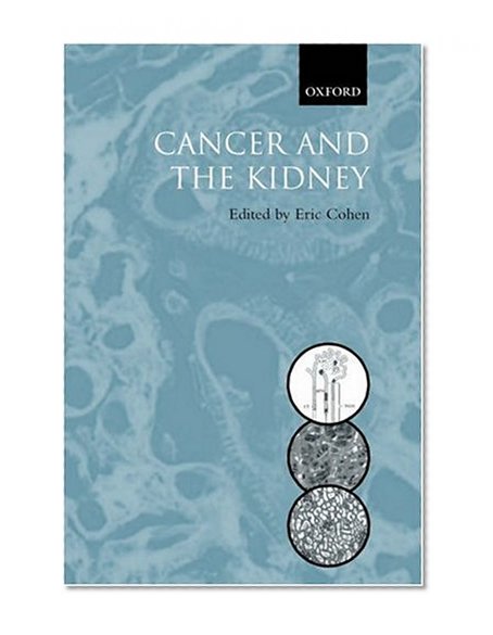 Book Cover Cancer and the Kidney