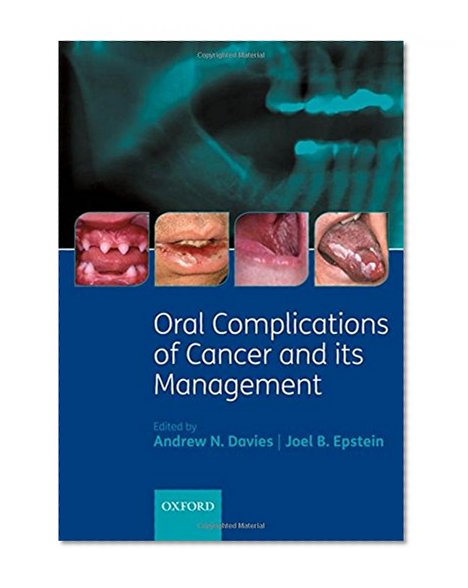 Book Cover Oral Complications of Cancer and its Management