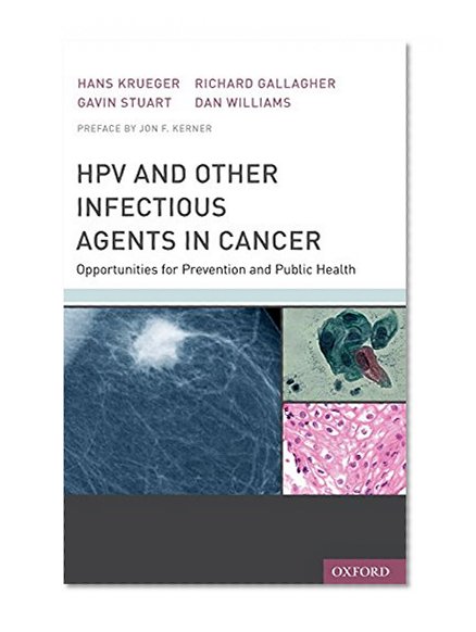 Book Cover HPV and Other Infectious Agents in Cancer: Opportunities for Prevention and Public Health
