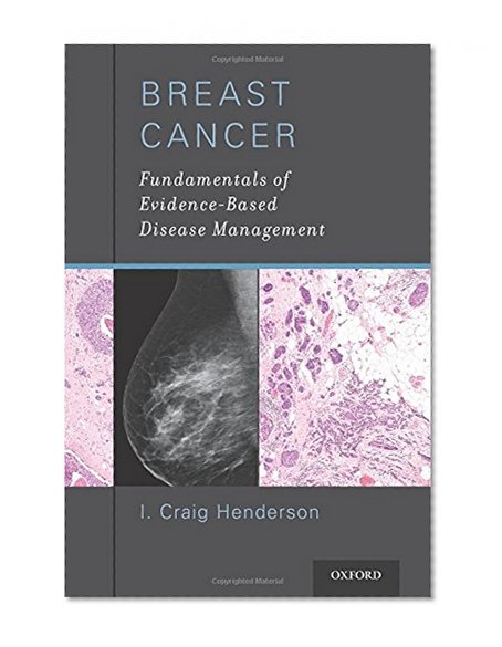 Book Cover Breast Cancer: Fundamentals of Evidence-Based Disease Management