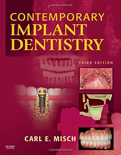 Book Cover Contemporary Implant Dentistry, 3e