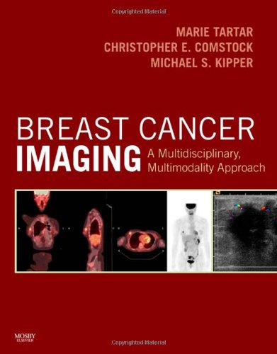 Book Cover Breast Cancer Imaging: A Multidisciplinary, Multimodality Approach, 1e