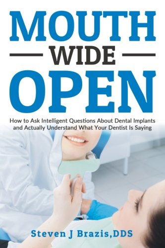 Book Cover Mouth Wide Open: How To Ask Intelligent Questions About Dental Implants and Actually Understand What Your Dentist Is Saying