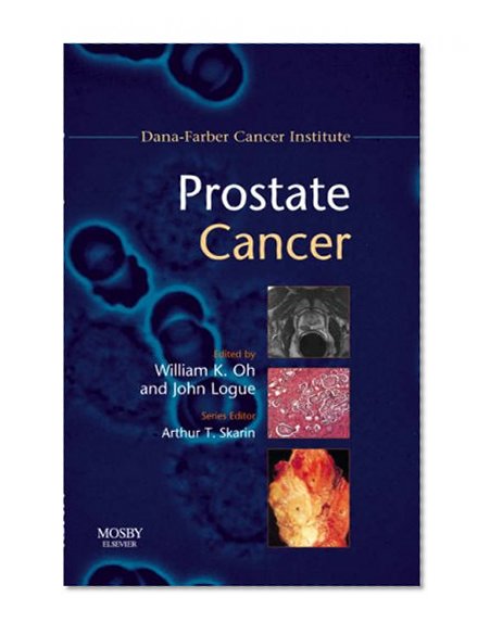 Book Cover Prostate Cancer: Dana-Farber Cancer Institute Handbook, 1e (Dana-Farber Cancer Institute Handbooks)