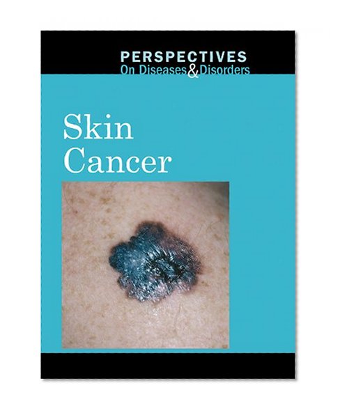 Book Cover Skin Cancer (Perspectives on Diseases and Disorders)