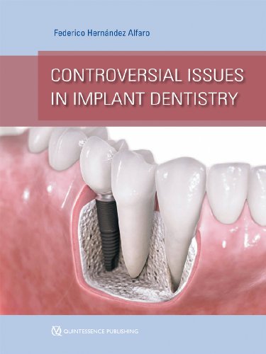 Book Cover Controversial Issues in Implant Dentistry
