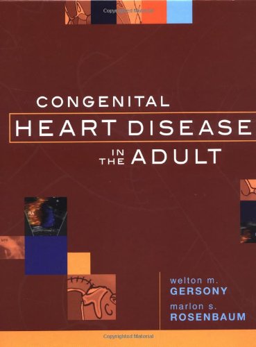 Congenital Heart Disease Adult