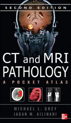 Book Cover CT & MRI Pathology: A Pocket Atlas, Second Edition
