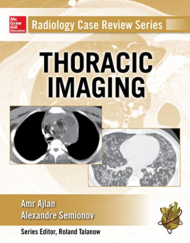 Book Cover Radiology Case Review Series: Thoracic Imaging