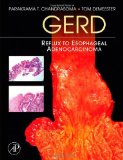 Gerd: Reflux to Esophageal Adenocarcinoma