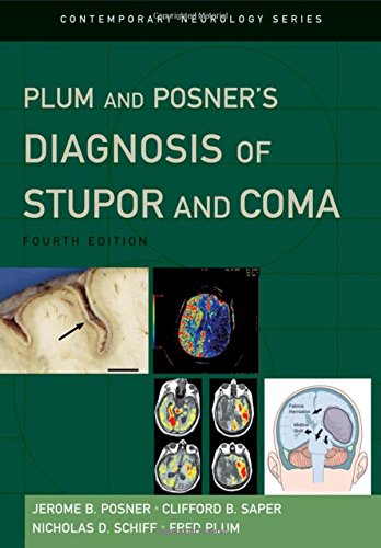 Book Cover Plum and Posner's Diagnosis of Stupor and Coma (Contemporary Neurology Series, 71)