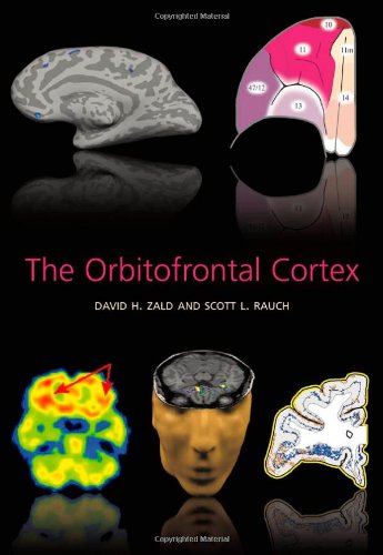 The Orbitofrontal Cortex