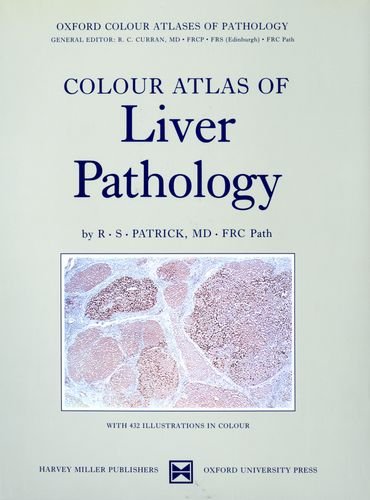 Colour Atlas of Liver Pathology (Oxford Medicine Publications)