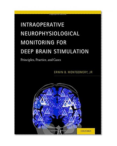 Intraoperative Neurophysiological Monitoring for Deep Brain Stimulation: Principles, Practice and Cases