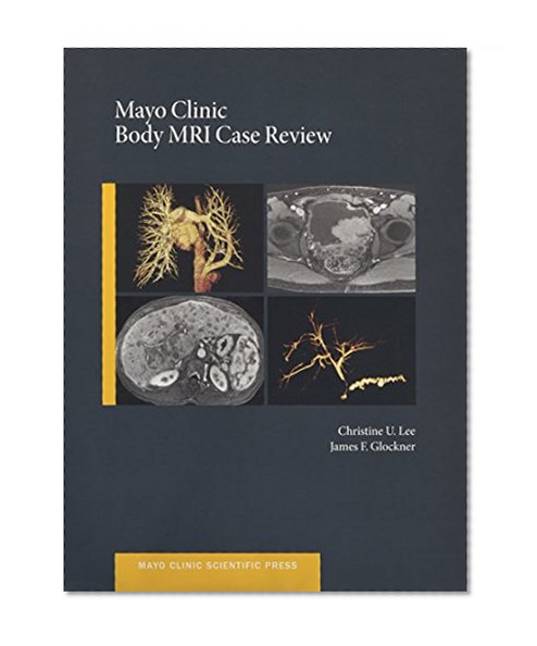 Book Cover Mayo Clinic Body MRI Case Review (Mayo Clinic Scientific Press)