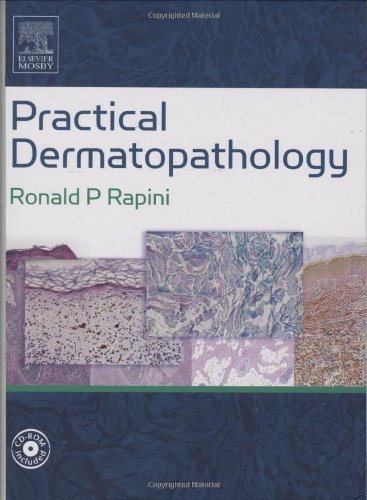 Practical Dermatopathology: Textbook with CD-ROM