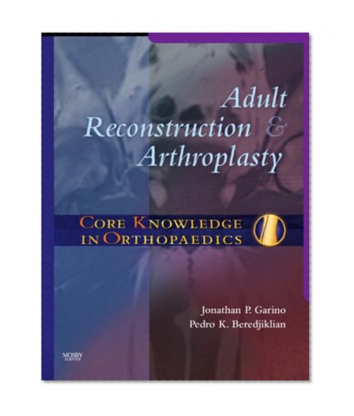 Core Knowledge in Orthopaedics: Adult Reconstruction and Arthroplasty, 1e