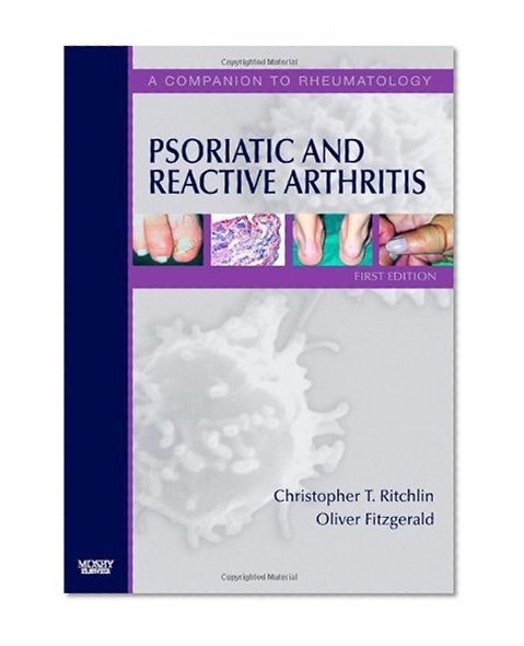 Psoriatic and Reactive Arthritis: A Companion to Rheumatology, 1e