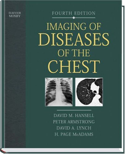 Imaging of Diseases of the Chest, 4e