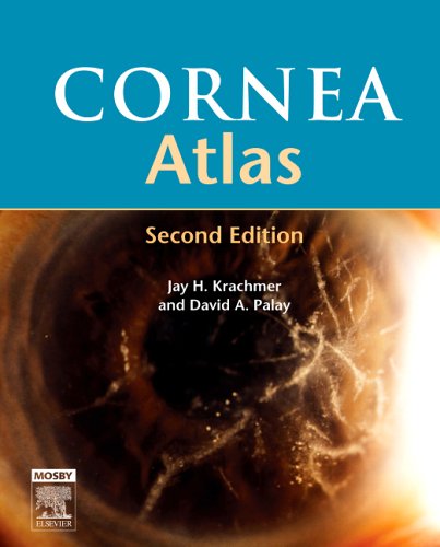 Cornea Atlas, 2e