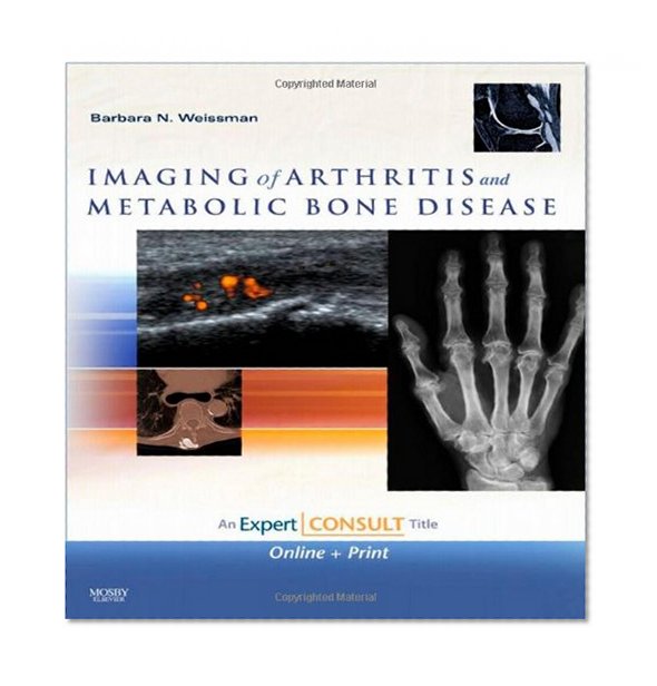 Imaging of Arthritis and Metabolic Bone Disease: Expert Consult - Online and Print, 1e (Expert Consult Title: Online + Print)