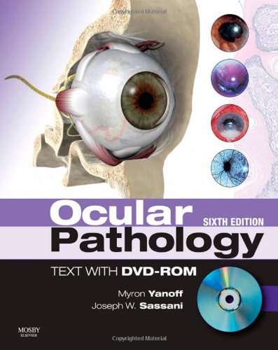 Ocular Pathology, 6e