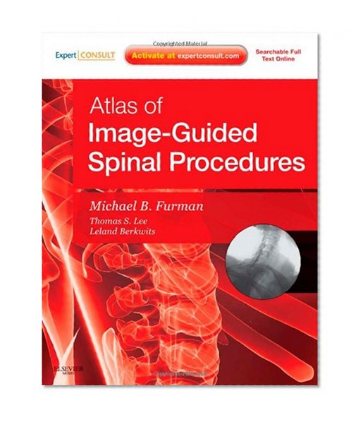 Atlas of Image-Guided Spinal Procedures, 1e