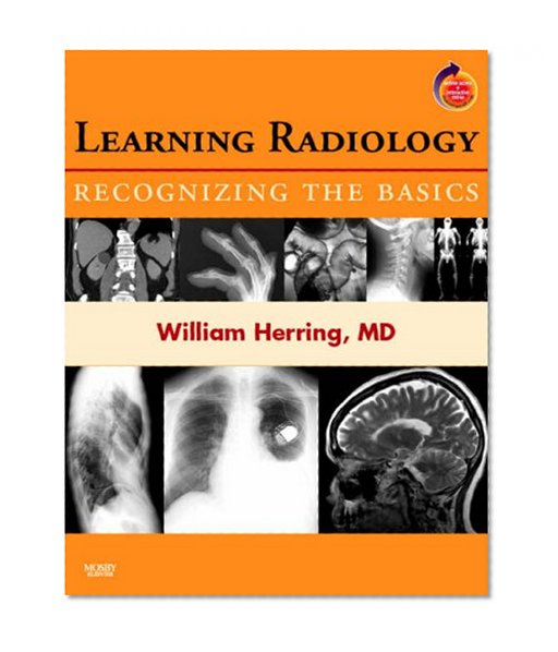 Learning Radiology: Recognizing the Basics (With STUDENT CONSULT Online Access), 1e