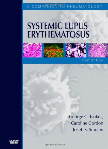 Systemic Lupus Erythematosus: A Companion to Rheumatology, 1e