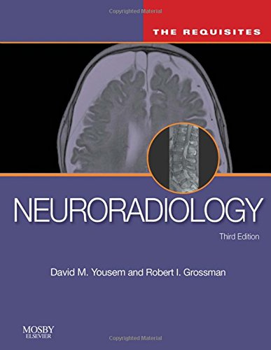 Neuroradiology: The Requisites (The Core Requisites)