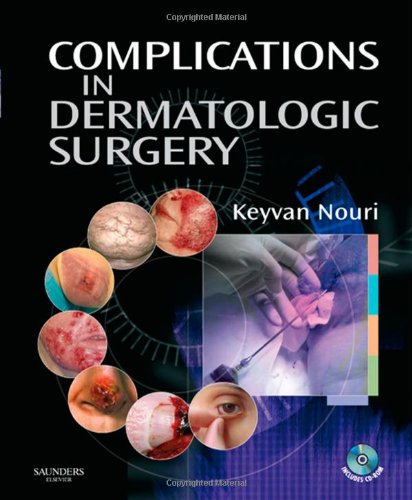 Complications in Dermatologic Surgery with CDROM, 1e