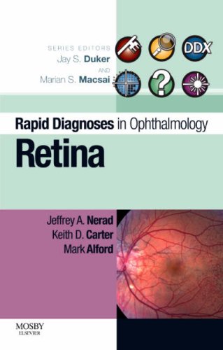 Rapid Diagnosis in Ophthalmology Series: Retina, 1e (Rapid Diagnoses in Ophthalmology)