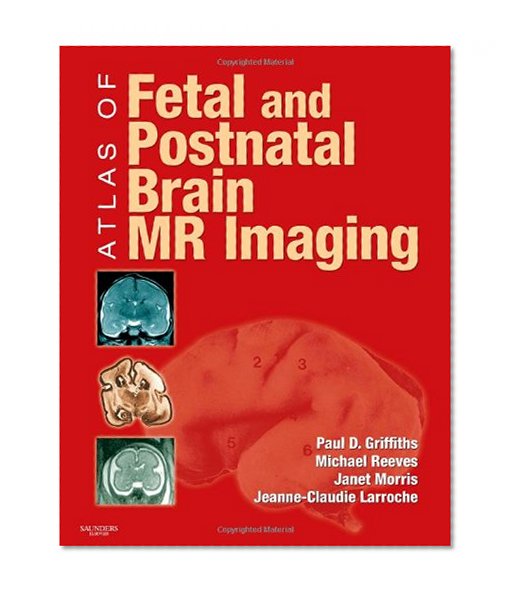 Atlas of Fetal and Postnatal Brain MR, 1e
