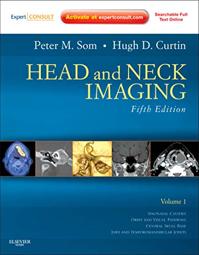 Book Cover Head and Neck Imaging (Expert Consult)