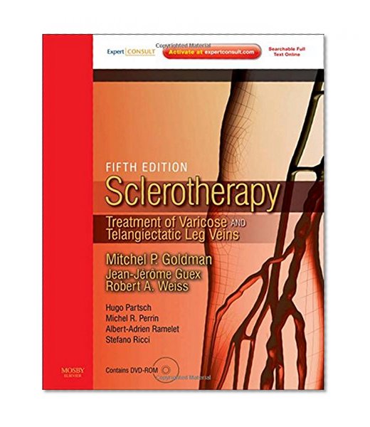 Sclerotherapy, w. DVD