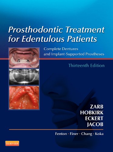 Book Cover Prosthodontic Treatment for Edentulous Patients: Complete Dentures and Implant-Supported Prostheses