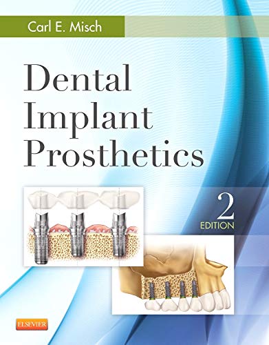 Book Cover Dental Implant Prosthetics