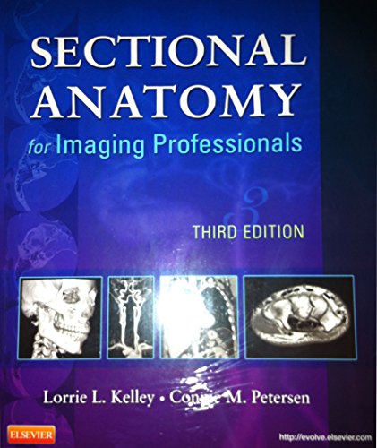 Sectional Anatomy for Imaging Professionals, 3e