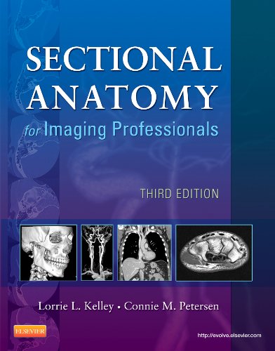 Sectional Anatomy for Imaging Professionals - Pageburst E-Book on Kno, 3e