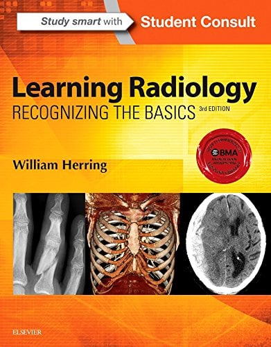 Book Cover Learning Radiology: Recognizing the Basics