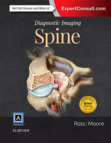 Book Cover Diagnostic Imaging: Spine