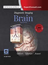 Book Cover Diagnostic Imaging: Brain